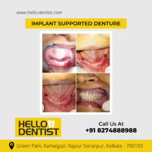 Hello Dentist Dental Clinic: Best Dental Clinic in South Kolkata