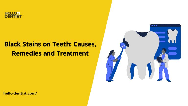 Black-Stains-on-Teeth-Causes