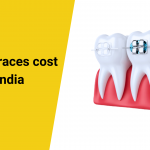 Dental-Braces-cost-in-India