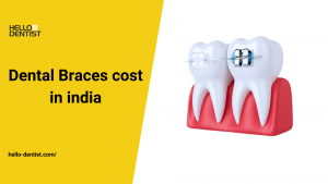 Dental-Braces-cost-in-India